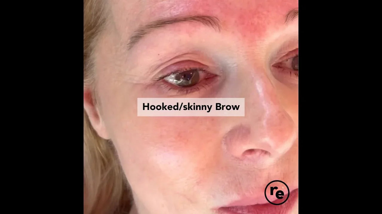 How to Correct a Hooked Brow for a Softer, More Balanced Shape